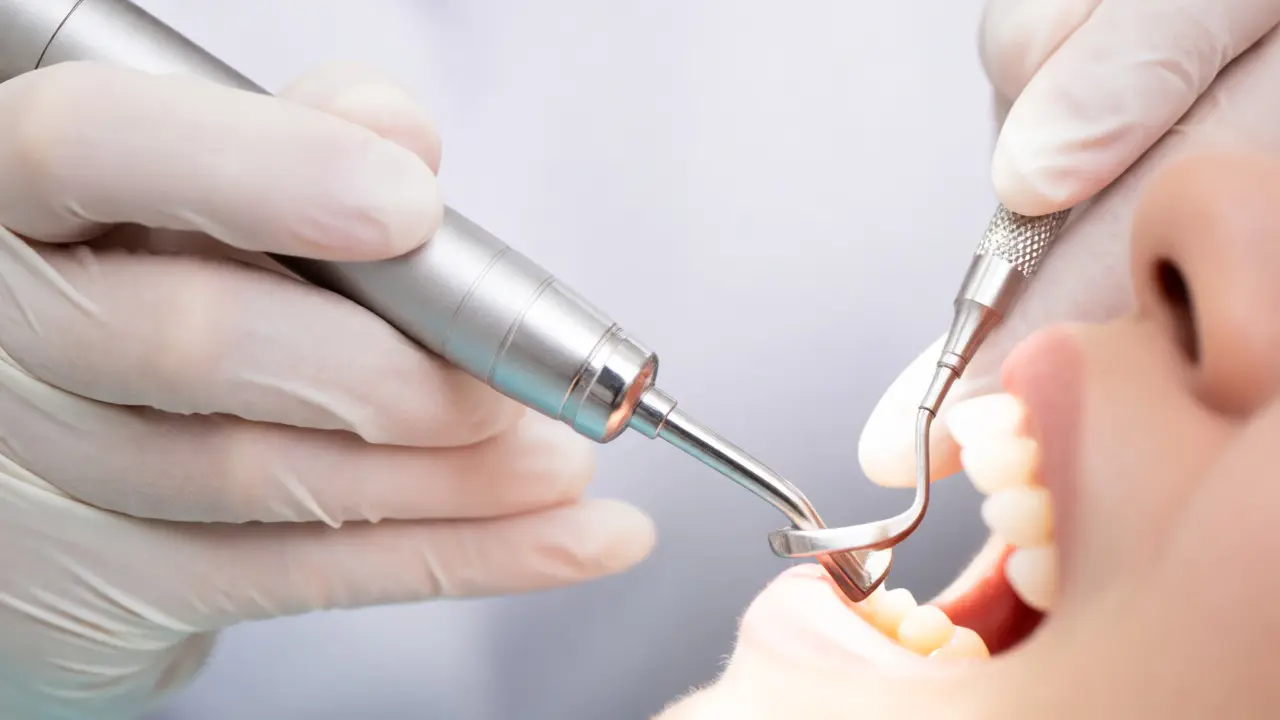 Detailní záběr na dentální hygienu s použitím ultrazvuku